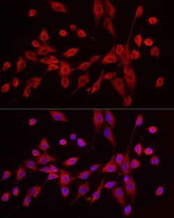 Invitrogen EXT1 Polyclonal Antibody 100 &mu;L; Unconjugated:Antibodies,