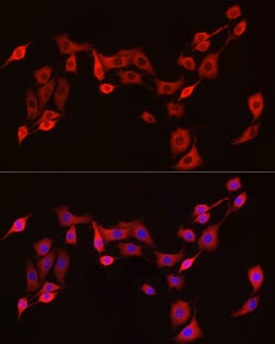 Invitrogen EXT1 Polyclonal Antibody 100 &mu;L; Unconjugated:Antibodies,