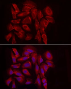 Invitrogen EXT1 Polyclonal Antibody 100 &mu;L; Unconjugated:Antibodies,