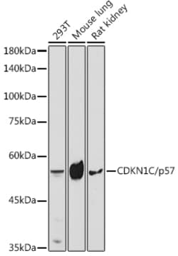 Invitrogen p57 Kip2 Polyclonal Antibody 100 &mu;L; Unconjugated:Antibodies,