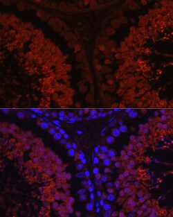 Invitrogen SPAM1 Polyclonal Antibody 100 &mu;L; Unconjugated:Antibodies,