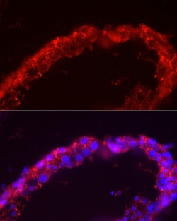 Invitrogen SPAM1 Polyclonal Antibody 100 &mu;L; Unconjugated:Antibodies,