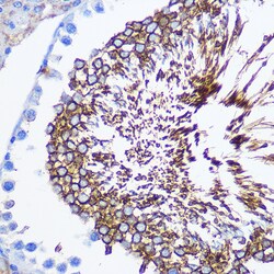 Invitrogen SPAM1 Polyclonal Antibody 100 &mu;L; Unconjugated:Antibodies,