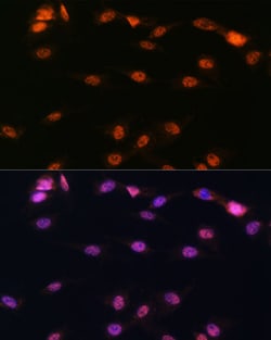 Invitrogen ALOX5 Polyclonal Antibody 100 &mu;L | Buy Online | Invitrogen&trade; | Fisher Scientific