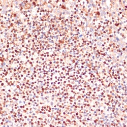 Invitrogen ALOX5 Polyclonal Antibody 100 &mu;L | Buy Online | Invitrogen&trade; | Fisher Scientific