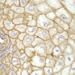 Invitrogen HLA-A Polyclonal Antibody 100 &mu;L; Unconjugated:Antibodies,
