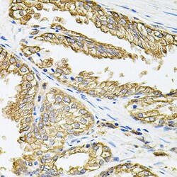 Invitrogen HLA-DQA1 Polyclonal Antibody 100 &mu;L; Unconjugated:Antibodies,