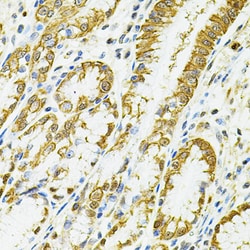 Invitrogen HLA-DQA1 Polyclonal Antibody 100 &mu;L; Unconjugated:Antibodies,
