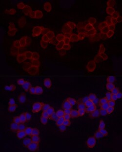 Invitrogen CD18 Polyclonal Antibody 100 &mu;L | Buy Online | Invitrogen&trade; | Fisher Scientific
