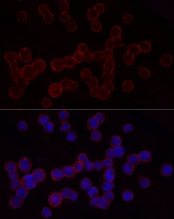 Invitrogen CD18 Polyclonal Antibody 100 &mu;L | Buy Online | Invitrogen&trade; | Fisher Scientific
