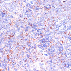 Invitrogen CD18 Polyclonal Antibody 100 &mu;L | Buy Online | Invitrogen&trade; | Fisher Scientific
