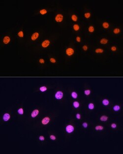 Invitrogen GCN5 Polyclonal Antibody 100 &mu;L | Buy Online | Invitrogen&trade; | Fisher Scientific