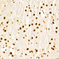 Invitrogen GCN5 Polyclonal Antibody 100 &mu;L | Buy Online | Invitrogen&trade; | Fisher Scientific