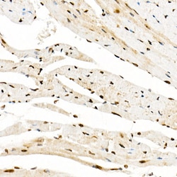 Invitrogen GCN5 Polyclonal Antibody 100 &mu;L | Buy Online | Invitrogen&trade; | Fisher Scientific