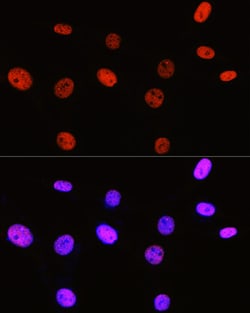 Invitrogen H3R2me2s Polyclonal Antibody 100 &mu;L; Unconjugated:Antibodies,
