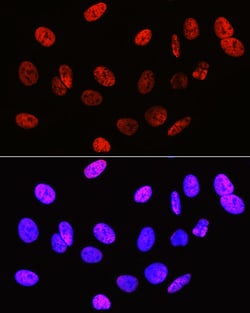 Invitrogen H3R2me2s Polyclonal Antibody 100 &mu;L; Unconjugated:Antibodies,