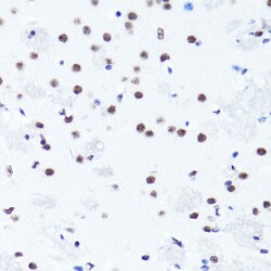 Invitrogen H3R2me2s Polyclonal Antibody 100 &mu;L; Unconjugated:Antibodies,