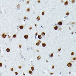 Invitrogen MEF2C Polyclonal Antibody 100 &mu;L; Unconjugated:Antibodies,