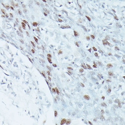 Invitrogen MEF2C Polyclonal Antibody 100 &mu;L; Unconjugated:Antibodies,
