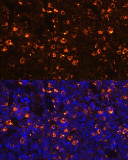 Invitrogen CLEC4D Polyclonal Antibody 100 &mu;L; Unconjugated:Antibodies,