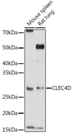 Invitrogen CLEC4D Polyclonal Antibody 100 &mu;L; Unconjugated:Antibodies,