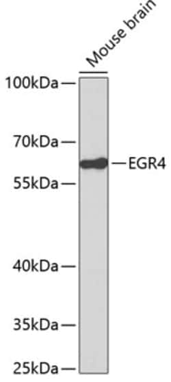 Invitrogen EGR4 Polyclonal Antibody 100 &mu;L; Unconjugated:Antibodies,