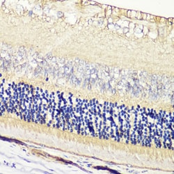 Invitrogen GRK1 Polyclonal Antibody 100 &mu;L; Unconjugated:Antibodies,