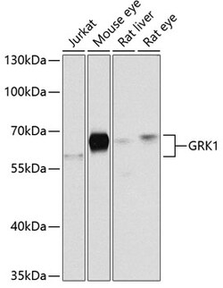 Invitrogen GRK1 Polyclonal Antibody 100 &mu;L; Unconjugated:Antibodies,