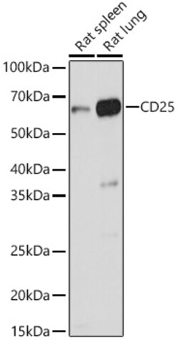 Invitrogen CD25 Polyclonal Antibody 100 &mu;L; Unconjugated:Antibodies,