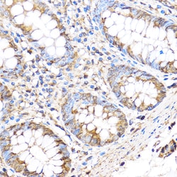 Invitrogen MMP17 Polyclonal Antibody 100 &mu;L; Unconjugated:Antibodies,