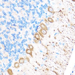Invitrogen MMP17 Polyclonal Antibody 100 &mu;L; Unconjugated:Antibodies,