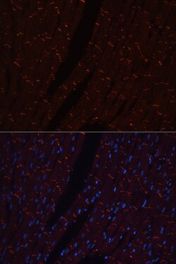 Invitrogen N-cadherin Polyclonal Antibody 100 &mu;L; Unconjugated:Antibodies,