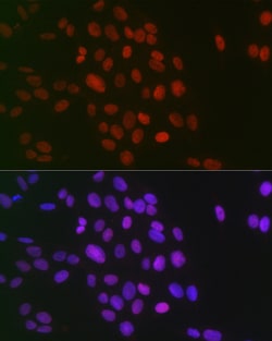 Invitrogen H3R26me2s Polyclonal Antibody 100 &mu;L; Unconjugated:Antibodies,