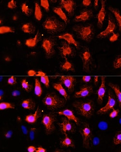 Invitrogen alpha Actinin 2 Polyclonal Antibody 100 &mu;L; Unconjugated:Antibodies,