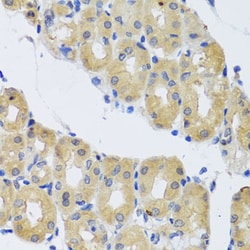 Invitrogen DYNC1I1 Polyclonal Antibody 100 μL; Unconjugated:Antibodies,