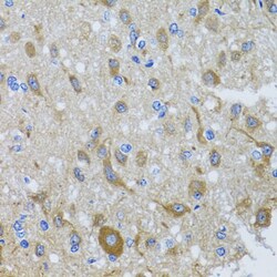 Invitrogen DYNC1I1 Polyclonal Antibody 100 μL; Unconjugated:Antibodies,