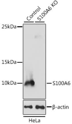 Invitrogen S100A6 Polyclonal Antibody 100 &mu;L | Buy Online | Invitrogen&trade; | Fisher Scientific