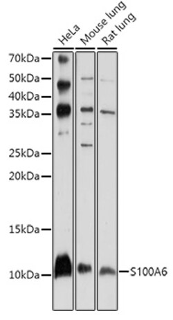 Invitrogen S100A6 Polyclonal Antibody 100 &mu;L | Buy Online | Invitrogen&trade; | Fisher Scientific