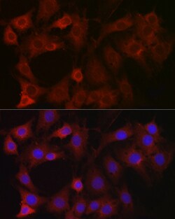 Invitrogen eIF4E2 Polyclonal Antibody 100 μL; Unconjugated:Antibodies,