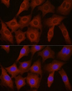 Invitrogen eIF4E2 Polyclonal Antibody 100 μL; Unconjugated:Antibodies,