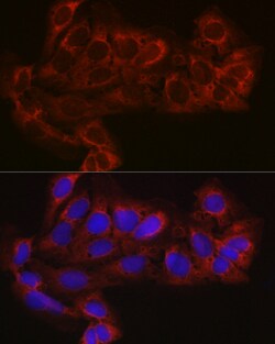 Invitrogen eIF4E2 Polyclonal Antibody 100 μL; Unconjugated:Antibodies,