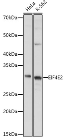 Invitrogen eIF4E2 Polyclonal Antibody 100 μL; Unconjugated:Antibodies,
