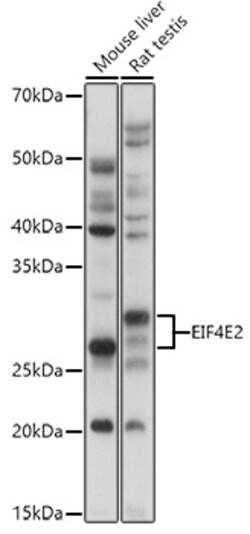 Invitrogen eIF4E2 Polyclonal Antibody 100 μL; Unconjugated:Antibodies,