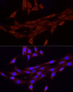 Invitrogen PIEZO1 Polyclonal Antibody 100 &mu;L; Unconjugated:Antibodies,