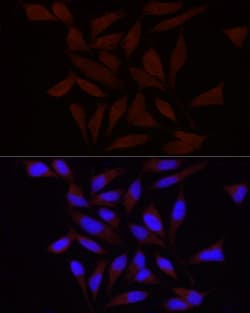 Invitrogen PIEZO1 Polyclonal Antibody 100 &mu;L; Unconjugated:Antibodies,