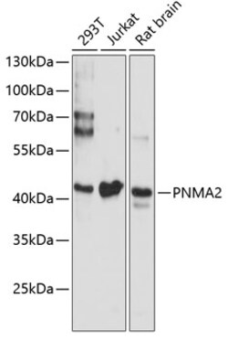 Invitrogen MA2 Polyclonal Antibody 100 &mu;L | Buy Online | Invitrogen&trade; | Fisher Scientific