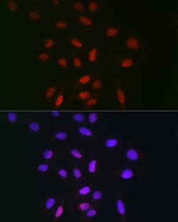 Invitrogen TDP1 Polyclonal Antibody 100 &mu;L; Unconjugated:Antibodies,