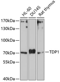 Invitrogen TDP1 Polyclonal Antibody 100 &mu;L; Unconjugated:Antibodies,