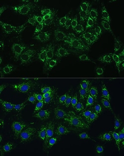 Invitrogen Cytochrome B5 Polyclonal Antibody 100 &mu;L; Unconjugated:Antibodies,