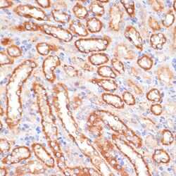 Invitrogen Cytochrome B5 Polyclonal Antibody 100 &mu;L; Unconjugated:Antibodies,
